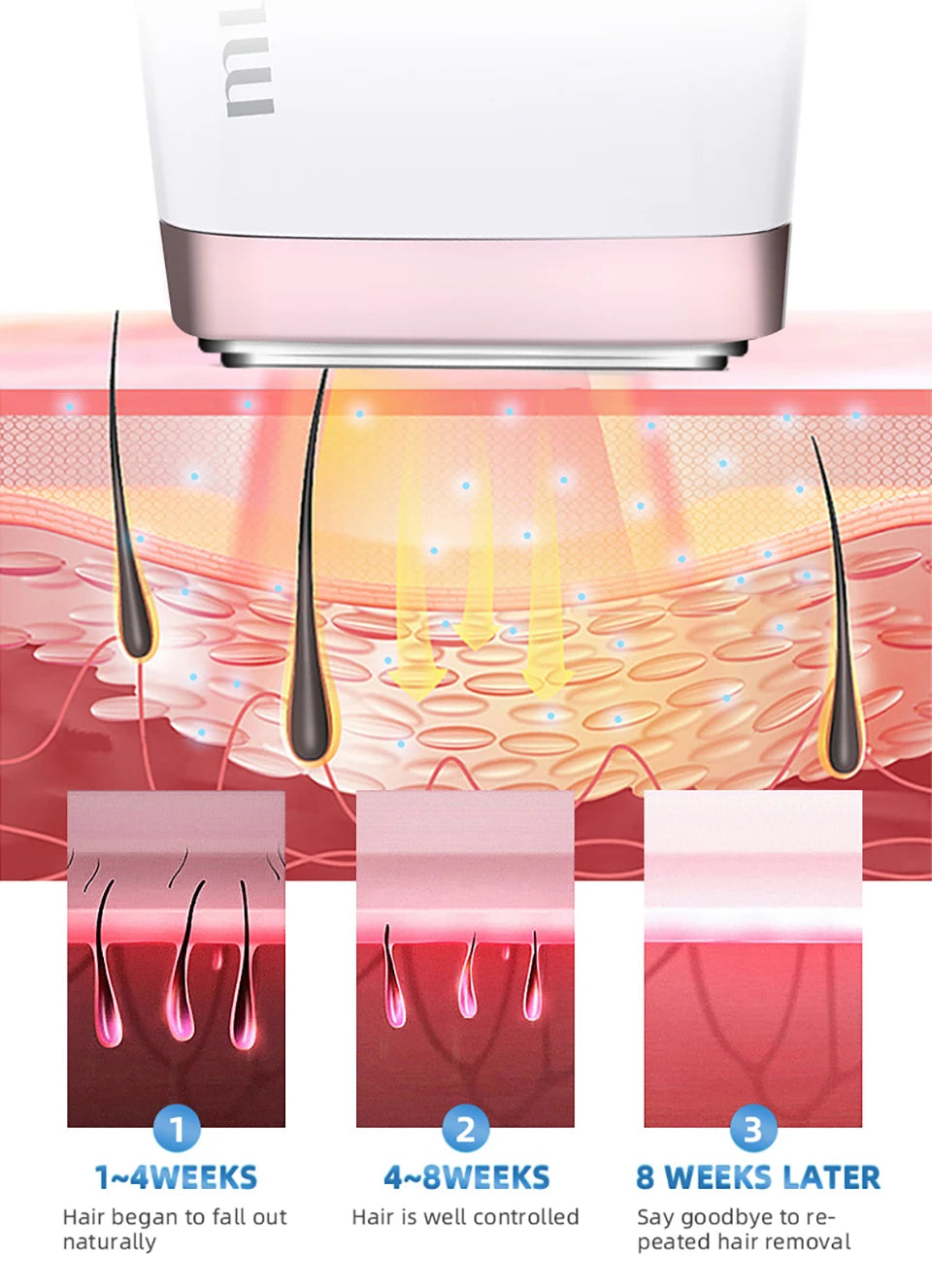 MLAY T4 IPL Laser Handheld Hair Removal Machine Ice Cool Permanent Face Body Bikini Epilator with 500000 Shots for Home Use